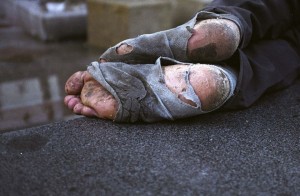 homeless feet